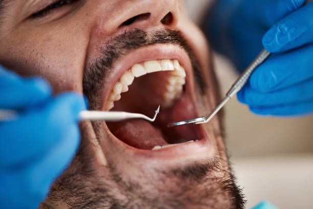 Best Walk-In Emergency Dentist in Seymour, WI